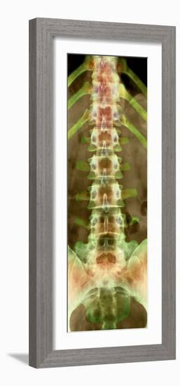 Healthy Lower Spine, X-ray-Science Photo Library-Framed Photographic Print