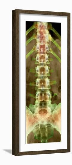 Healthy Lower Spine, X-ray-Science Photo Library-Framed Photographic Print