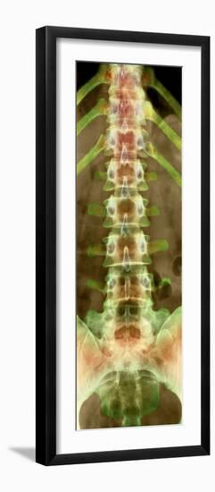 Healthy Lower Spine, X-ray-Science Photo Library-Framed Photographic Print