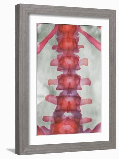 Healthy Lower Spine, X-ray-Science Photo Library-Framed Photographic Print