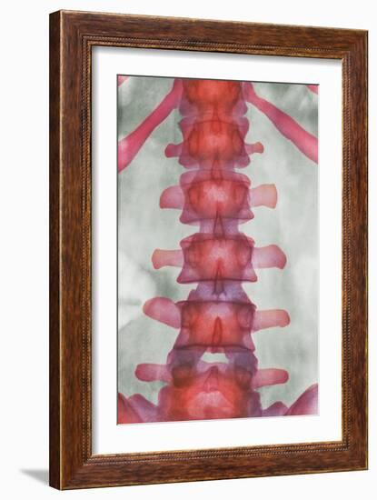 Healthy Lower Spine, X-ray-Science Photo Library-Framed Photographic Print