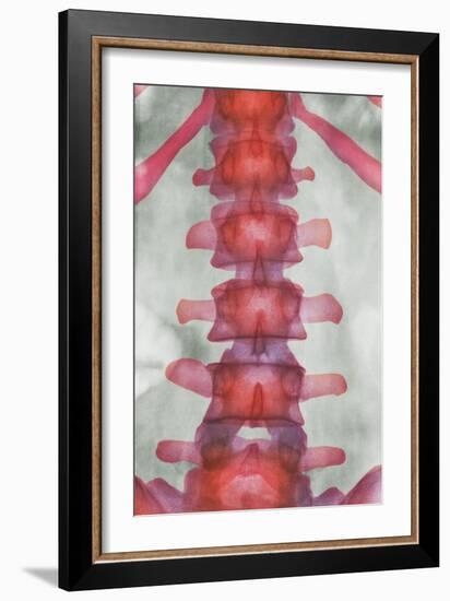 Healthy Lower Spine, X-ray-Science Photo Library-Framed Photographic Print