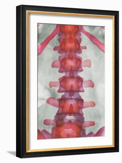 Healthy Lower Spine, X-ray-Science Photo Library-Framed Photographic Print