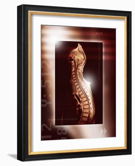 Healthy Spine, MRI Scan-Miriam Maslo-Framed Photographic Print