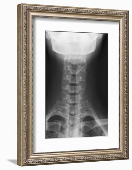 Healthy Spine of the Neck, X-ray'-Du Cane Medical-Framed Photographic Print