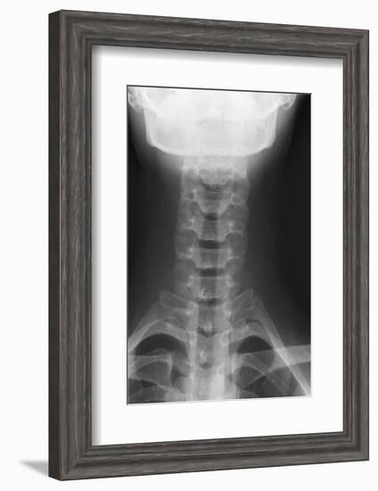 Healthy Spine of the Neck, X-ray'-Du Cane Medical-Framed Photographic Print