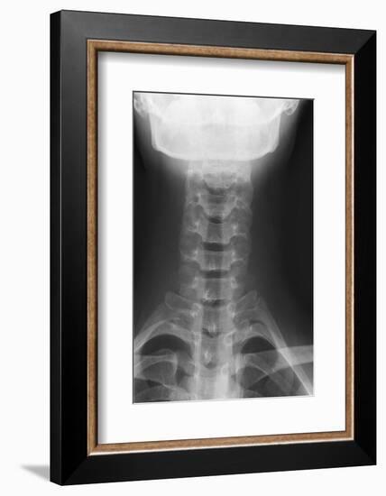 Healthy Spine of the Neck, X-ray'-Du Cane Medical-Framed Photographic Print