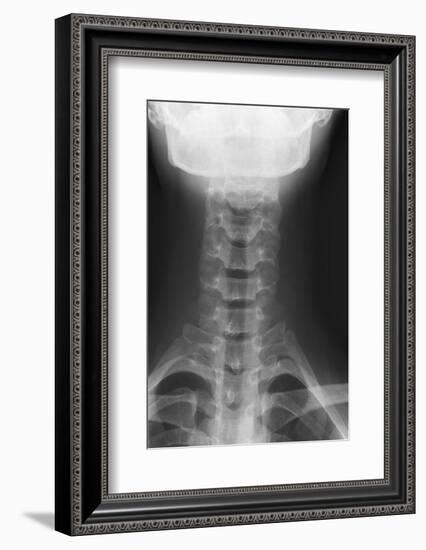 Healthy Spine of the Neck, X-ray'-Du Cane Medical-Framed Photographic Print