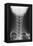 Healthy Spine of the Neck, X-ray'-Du Cane Medical-Framed Premier Image Canvas