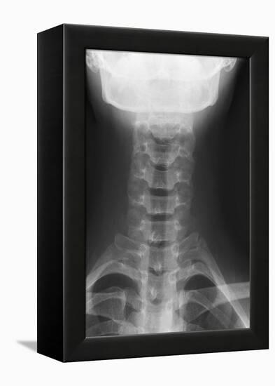 Healthy Spine of the Neck, X-ray'-Du Cane Medical-Framed Premier Image Canvas