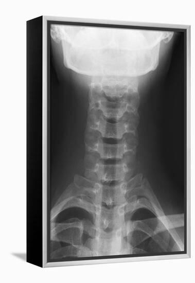 Healthy Spine of the Neck, X-ray'-Du Cane Medical-Framed Premier Image Canvas