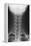 Healthy Spine of the Neck, X-ray'-Du Cane Medical-Framed Premier Image Canvas