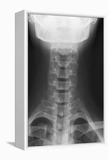 Healthy Spine of the Neck, X-ray'-Du Cane Medical-Framed Premier Image Canvas