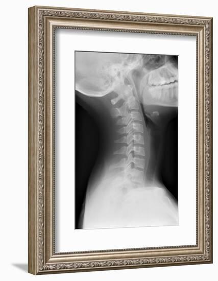 Healthy Spine of the Neck, X-ray'-Du Cane Medical-Framed Photographic Print