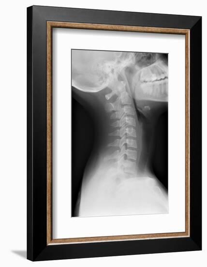 Healthy Spine of the Neck, X-ray'-Du Cane Medical-Framed Photographic Print