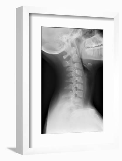 Healthy Spine of the Neck, X-ray'-Du Cane Medical-Framed Photographic Print