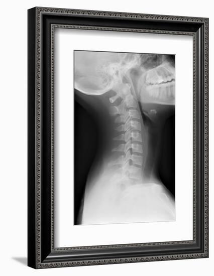 Healthy Spine of the Neck, X-ray'-Du Cane Medical-Framed Photographic Print