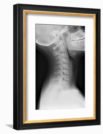 Healthy Spine of the Neck, X-ray'-Du Cane Medical-Framed Photographic Print