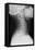 Healthy Spine of the Neck, X-ray'-Du Cane Medical-Framed Premier Image Canvas