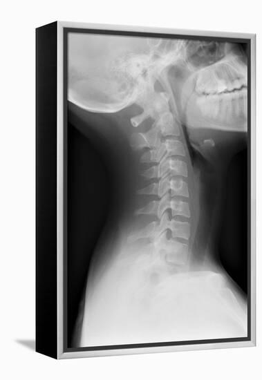 Healthy Spine of the Neck, X-ray'-Du Cane Medical-Framed Premier Image Canvas