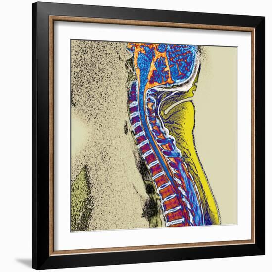 Healthy Spine-Du Cane Medical-Framed Premium Photographic Print