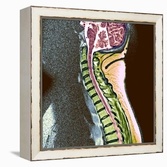 Healthy Spine-Du Cane Medical-Framed Premier Image Canvas