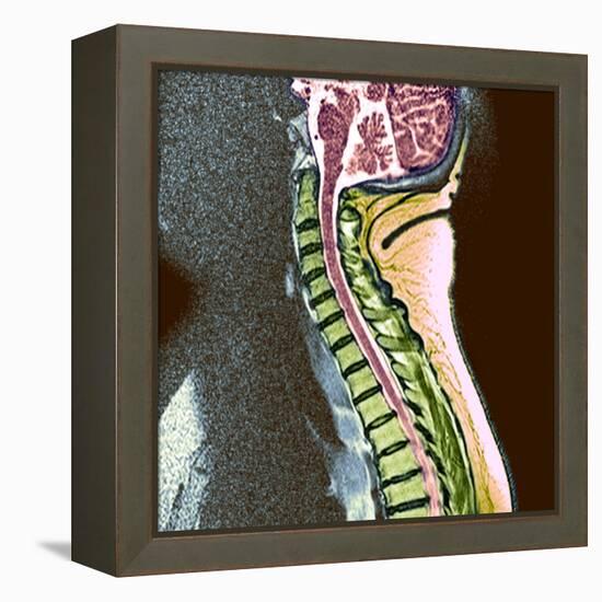 Healthy Spine-Du Cane Medical-Framed Premier Image Canvas