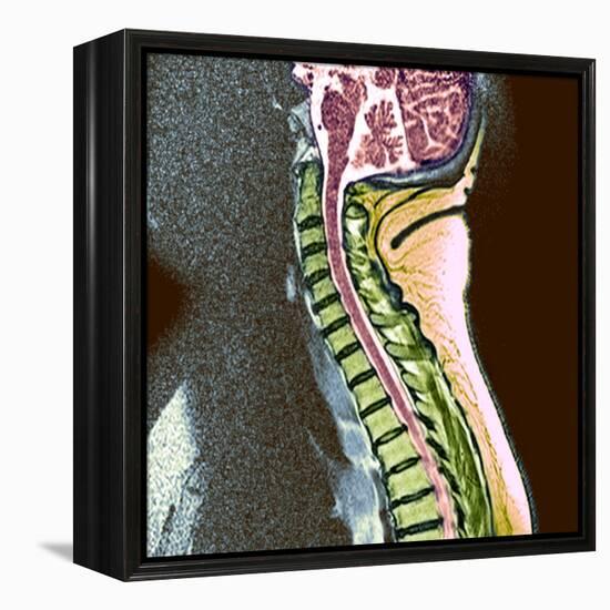 Healthy Spine-Du Cane Medical-Framed Premier Image Canvas