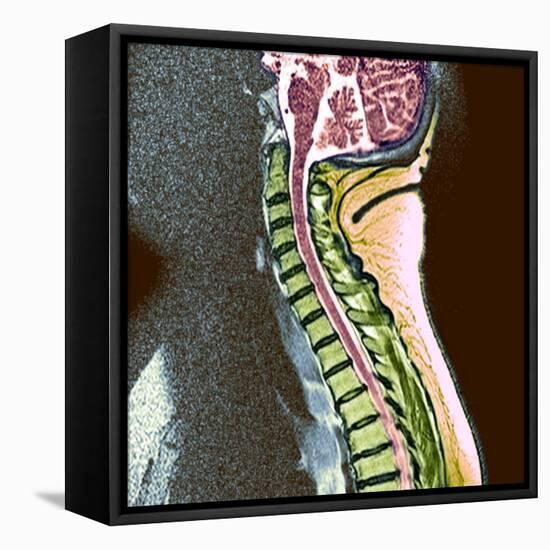 Healthy Spine-Du Cane Medical-Framed Premier Image Canvas