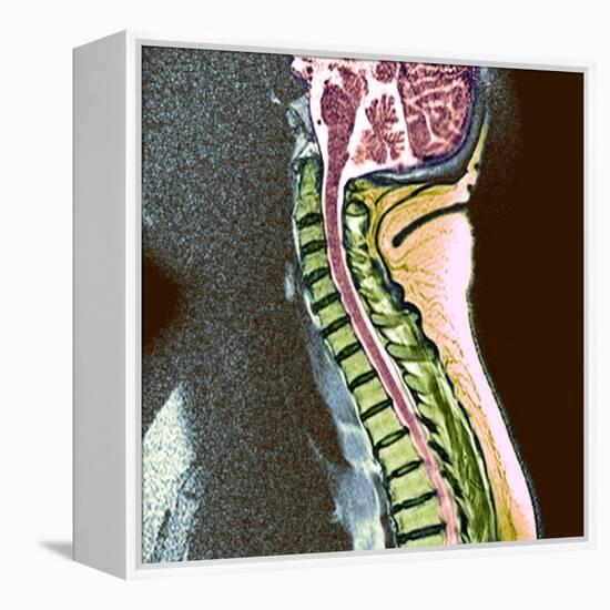 Healthy Spine-Du Cane Medical-Framed Premier Image Canvas