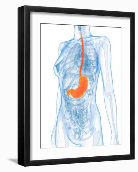 Healthy Stomach, Artwork-SCIEPRO-Framed Photographic Print
