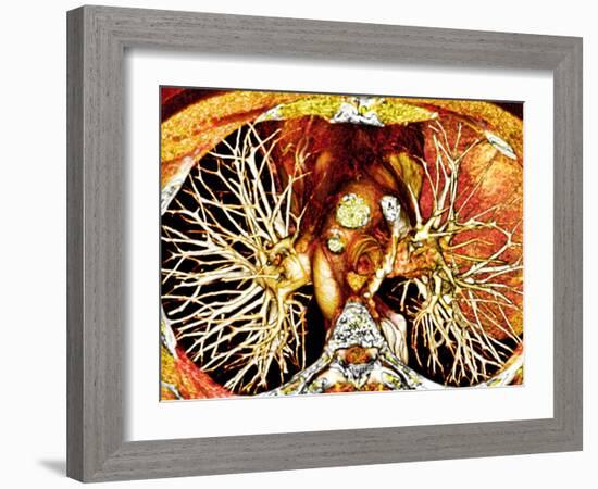 Heart And Lungs, 3D CT Scan-PASIEKA-Framed Photographic Print