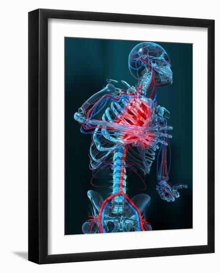 Heart Attack, Artwork-Carl Goodman-Framed Photographic Print