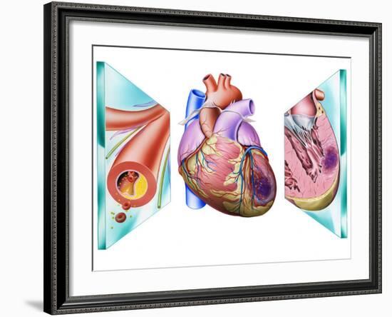 Heart Attack-John Bavosi-Framed Photographic Print