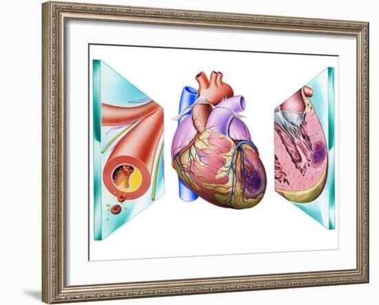 Heart Attack-John Bavosi-Framed Photographic Print