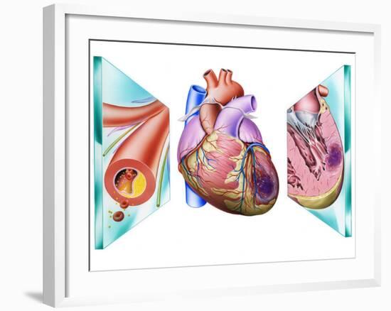 Heart Attack-John Bavosi-Framed Photographic Print