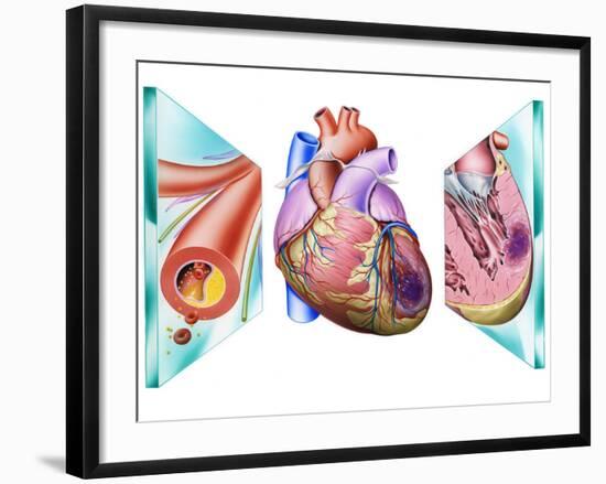 Heart Attack-John Bavosi-Framed Photographic Print