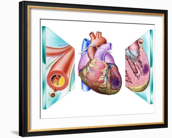 Heart Attack-John Bavosi-Framed Photographic Print