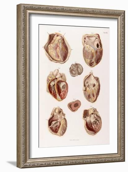 Heart, Cavities and Valves, Illustration, 1878-Science Source-Framed Giclee Print