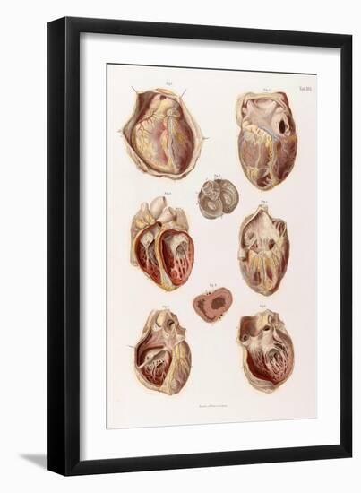 Heart, Cavities and Valves, Illustration, 1878-Science Source-Framed Giclee Print