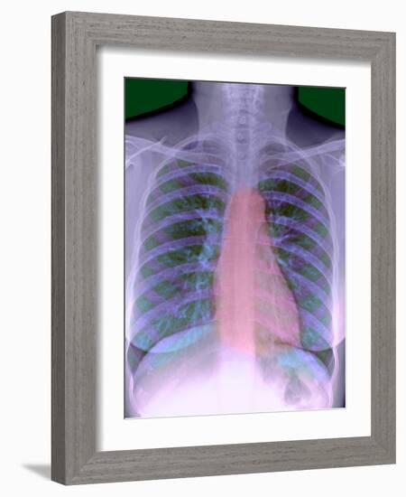 Heart, Chest X-ray-Du Cane Medical-Framed Photographic Print