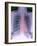 Heart, Chest X-ray-Du Cane Medical-Framed Photographic Print