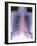 Heart, Chest X-ray-Du Cane Medical-Framed Photographic Print