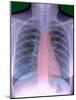 Heart, Chest X-ray-Du Cane Medical-Mounted Photographic Print