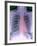 Heart, Chest X-ray-Du Cane Medical-Framed Photographic Print