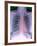 Heart, Chest X-ray-Du Cane Medical-Framed Photographic Print