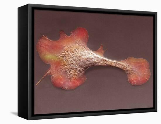 Heart Muscle Cell, SEM-Thomas Deerinck-Framed Premier Image Canvas