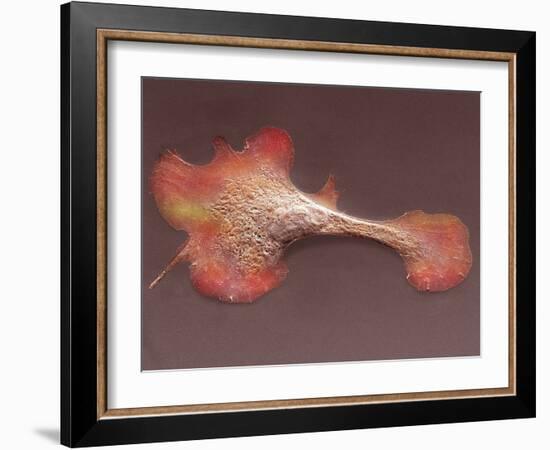 Heart Muscle Cell, SEM-Thomas Deerinck-Framed Photographic Print