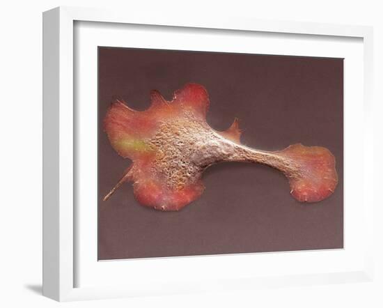 Heart Muscle Cell, SEM-Thomas Deerinck-Framed Photographic Print