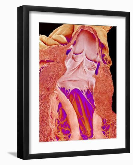 Heart Valves And Strings, SEM-Susumu Nishinaga-Framed Photographic Print